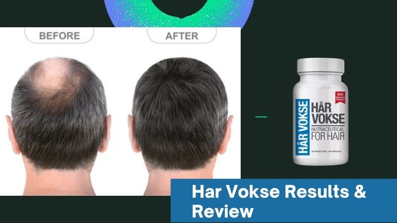 Hair Vokse Supplement for Hair Growth