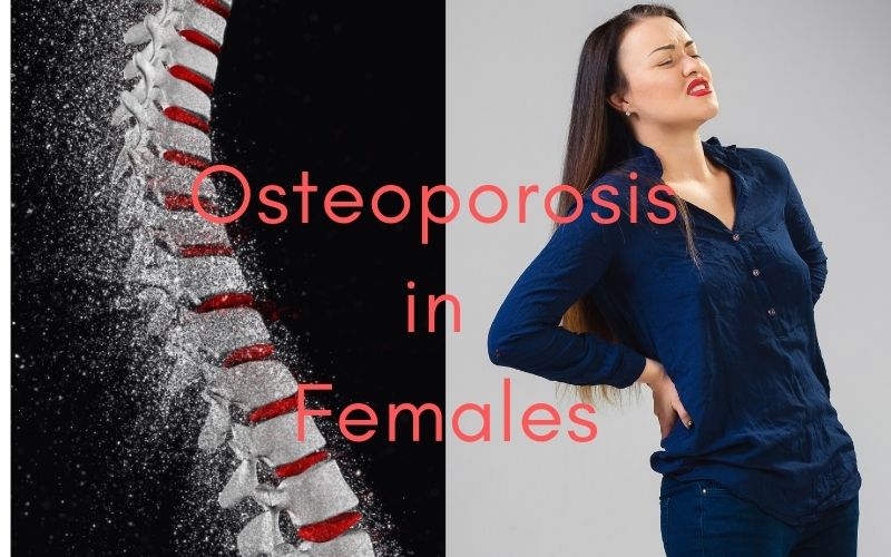 Causes of osteoporosis in females