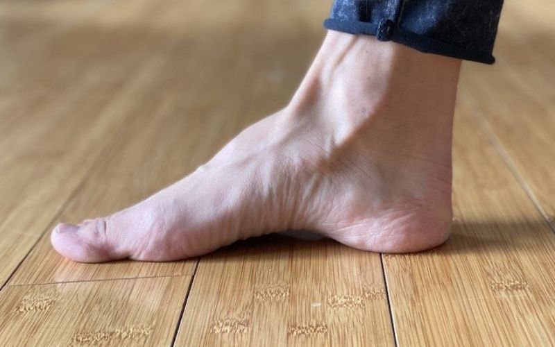 exercise to get rid of flat feet