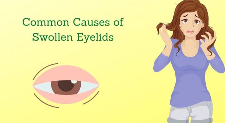 Causes of swollen eyelids